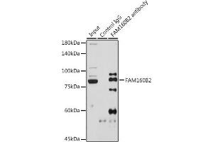 Immunoprecipitation analysis of 600 μg extracts of Rat testis cells using 3 μg FB2 antibody (ABIN7267111). (FAM160B2 抗体)