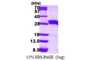 SDS-PAGE (SDS) image for Steroidogenic Acute Regulatory Protein (STAR) (AA 64-285) protein (His tag) (ABIN667607) (STAR Protein (AA 64-285) (His tag))