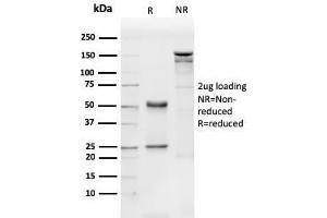 SDS-PAGE Analysis Purified CD31 Mouse Monoclonal Antibody (PECAM1/3540). (CD31 抗体  (AA 625-738))