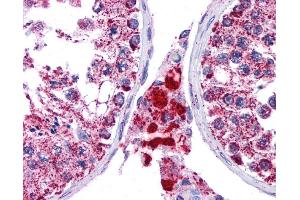 SFTPC antibody was used for immunohistochemistry at a concentration of 4-8 ug/ml. (Surfactant Protein C 抗体  (N-Term))