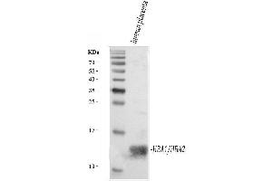 Western blot analysis of Hemoglobin using anti-Hemoglobin antibody (ABIN5518839). (HBA1 抗体  (AA 2-142))