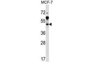 ARFIP1 Antibody (Center) western blot analysis in MCF-7 cell line lysates (35µg/lane). (ARFIP1 抗体  (Middle Region))