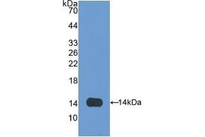 Detection of Recombinant OLFM4, Rat using Polyclonal Antibody to Olfactomedin 4 (OLFM4) (Olfactomedin 4 抗体  (AA 405-511))