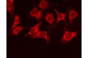 IF analysis of Hela with beta-Actin Antibody diluted at 1:500.
