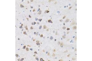 Immunohistochemistry (Paraffin-embedded Sections) (IHC (p)) image for anti-Karyopherin (Importin) alpha 4 (KPNA4) (AA 1-240) antibody (ABIN3015855)