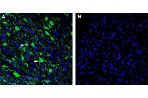 Expression of L1CAM in mouse deep cerebellar nuclei.