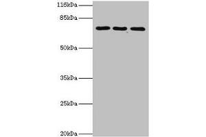 Western blot All lanes: ZNF699 antibody at 2 μg/mL Lane 1: Jurkat whole cell lysate Lane 2: K562 whole cell lysate Lane 3: U87 whole cell lysate Secondary Goat polyclonal to rabbit IgG at 1/10000 dilution Predicted band size: 74 kDa Observed band size: 74 kDa (ZNF699 抗体  (AA 19-195))