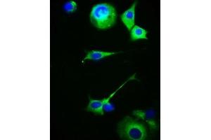 Immunofluorescence staining of MCF-7 cells with ABIN7159217 at 1:100, counter-stained with DAPI. (MC5 Receptor 抗体  (AA 1-37))