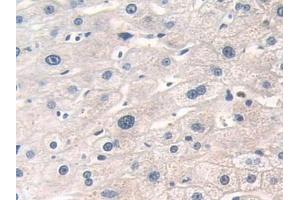 Detection of DOK3 in Human Liver Tissue using Polyclonal Antibody to Docking Protein 3 (DOK3) (DOK3 抗体  (AA 128-385))