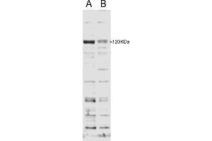 ABIN185714 staining of HFF cell lysate with B) 100nM siRNA or A) control siRNA. (SECISBP2 抗体  (Internal Region))