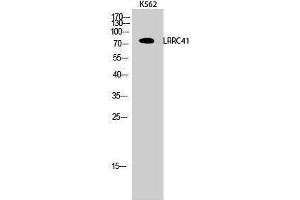 Western Blotting (WB) image for anti-Leucine Rich Repeat Containing 41 (LRRC41) (Internal Region) antibody (ABIN3185414) (LRRC41 抗体  (Internal Region))