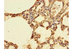 Immunohistochemistry of paraffin-embedded human lung tissue using ABIN7156574 at dilution of 1:100 (IFI27L2 抗体  (AA 87-130))