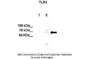 Lanes:  Lane 1: Untreated human U251 cell lysate Lane 2: IL-1beta treated human U251 cell lysate Primary Antibody Dilution:  1:500 Secondary Antibody:  Anti-rabbit-HRP Secondary Antibody Dilution:  1:500 Gene Name:  TLR4 Submitted by:  Anonymous (TLR4 抗体  (C-Term))