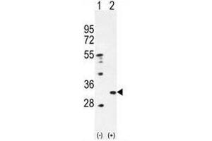 Western blot analysis of PRDX4 (arrow) using rabbit polyclonal PRDX4 Antibody (Center) . (Peroxiredoxin 4 抗体  (Middle Region))