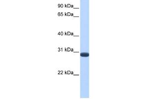 WB Suggested Anti-DUSP19 Antibody Titration: 0. (DUSP19 抗体  (C-Term))