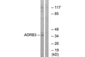 Western blot analysis of extracts from K562 cells, using ADRB3 Antibody. (ADRB3 抗体  (AA 250-299))
