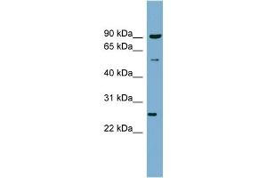 WB Suggested Anti-VAMP7 Antibody Titration:  0. (VAMP7 抗体  (N-Term))