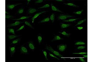Immunofluorescence of purified MaxPab antibody to UBL7 on HeLa cell. (UBL7 抗体  (AA 1-380))