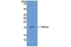 Western Blotting (WB) image for anti-Succinate Dehydrogenase Complex, Subunit D, Integral Membrane Protein (SDHD) (AA 1-159) antibody (ABIN7441616)