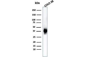 Western Blot Analysis of COLO-38 cell lysate using gp100 Rabbit Recombinant Monoclonal Antibody (PMEL/1825R). (Recombinant Melanoma gp100 抗体)