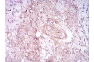 Immunohistochemistry (IHC) image for anti-Matrix Metallopeptidase 14 (Membrane-inserted) (MMP14) (AA 112-246) antibody (ABIN5542659)