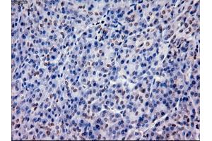 Immunohistochemical staining of paraffin-embedded lung using anti-EpCAM (ABIN2452677) mouse monoclonal antibody. (EpCAM 抗体  (AA 24-265))