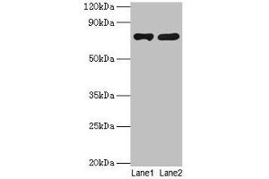 Western blot All lanes: PARN antibody at 2 μg/mL Lane 1: Jurkat whole cell lysate Lane 2: A431 whole cell lysate Secondary Goat polyclonal to rabbit IgG at 1/10000 dilution Predicted band size: 74, 67, 68, 53 kDa Observed band size: 74 kDa (PARN 抗体  (AA 1-639))