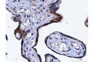 IHC analysis of YWHAE using anti-YWHAE antibody (ABIN7599165).