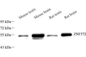 Western blot analysis of ZNF572 (ABIN7076268) at dilution of 1: 2000 (ZNF572 抗体)