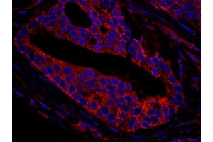 Immunofluorescence (IF) image for anti-CCR4-NOT Transcription Complex, Subunit 3 (CNOT3) (AA 525-575) antibody (ABIN7448941) (CNOT3 抗体  (AA 525-575))