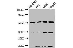 Western Blot Positive WB detected in: SH-SY5Y whole cell lysate, PC-3 whole cell lysate, A549 whole cell lysate, HepG2 whole cell lysate All lanes: NAGPA antibody at 3. (NAGPA 抗体  (AA 327-438))