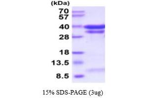 Cathepsin B Protein (CTSB) (AA 18-339) (His tag)