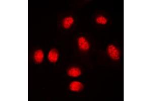 Immunofluorescent analysis of RUNX1 staining in THP1 cells. (RUNX1 抗体  (Center))