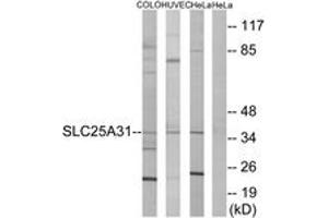 Western Blotting (WB) image for anti-Solute Carrier Family 25 (Mitochondrial Carrier, Adenine Nucleotide Translocator), Member 31 (SLC25A31) (AA 131-180) antibody (ABIN1534605)