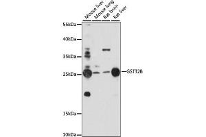 Western blot analysis of extracts of various cell lines, using GSTT2B antibody. (GSTT2B 抗体)