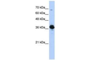 Image no. 1 for anti-ATPase, H+ Transporting, Lysosomal 38kDa, V0 Subunit D2 (ATP6V0D2) (AA 251-300) antibody (ABIN6743840) (ATP6V0D2 抗体  (AA 251-300))