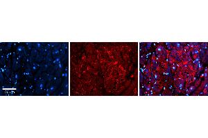 Rabbit Anti-S100A8 Antibody Catalog Number: ARP61367_P050 Formalin Fixed Paraffin Embedded Tissue: Human heart Tissue Observed Staining: Secreted Primary Antibody Concentration: 1:100 Other Working Concentrations: 1:600 Secondary Antibody: Donkey anti-Rabbit-Cy3 Secondary Antibody Concentration: 1:200 Magnification: 20X Exposure Time: 0. (S100A8 抗体  (Middle Region))