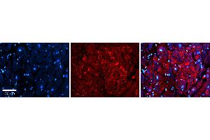 Rabbit Anti-S100A8 Antibody Catalog Number: ARP61367_P050 Formalin Fixed Paraffin Embedded Tissue: Human heart Tissue Observed Staining: Secreted Primary Antibody Concentration: 1:100 Other Working Concentrations: 1:600 Secondary Antibody: Donkey anti-Rabbit-Cy3 Secondary Antibody Concentration: 1:200 Magnification: 20X Exposure Time: 0.
