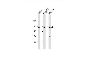 All lanes : Anti-KLB Antibody (N-Term) at 1:2000 dilution Lane 1: A549 whole cell lysate Lane 2: HepG2 whole cell lysate Lane 3: MCF-7 whole cell lysate Lysates/proteins at 20 μg per lane. (Klotho beta 抗体  (AA 1-29))