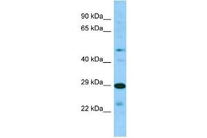 Host: Rabbit Target Name: SIRPB2 Sample Type: 721_B Whole Cell lysates Antibody Dilution: 1. (SIRPb2 抗体  (C-Term))