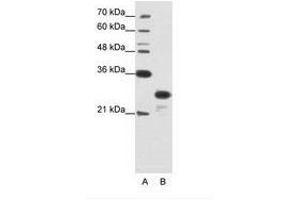 Image no. 2 for anti-Acidic (Leucine-Rich) Nuclear phosphoprotein 32 Family, Member A (ANP32A) (N-Term) antibody (ABIN202122) (PHAP1 抗体  (N-Term))