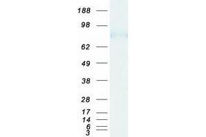 Western Blotting (WB) image for RalA Binding Protein 1 (RALBP1) protein (Myc-DYKDDDDK Tag) (ABIN2730442)