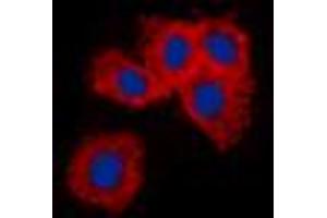 Immunofluorescent analysis of Vimentin staining in A549 cells. (Vimentin 抗体  (N-Term))