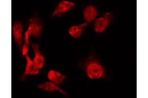 ABIN6267228 staining 293 by IF/ICC. (Aurora A 抗体  (pThr288))