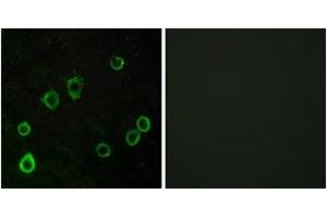 Immunofluorescence analysis of LOVO cells, using ADORA2A Antibody. (Adenosine A2a Receptor 抗体  (AA 321-370))