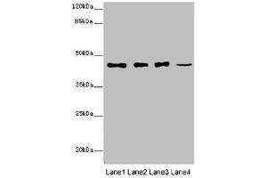 Western blot All lanes: SIRPB1 antibody at 6 μg/mL Lane 1: A549 whole cell lysate Lane 2: PC-3 whole cell lysate Lane 3: A375 whole cell lysate Lane 4: Mouse heart tissue Secondary Goat polyclonal to rabbit IgG at 1/10000 dilution Predicted band size: 44, 20 kDa Observed band size: 44 kDa (SIRPB1 抗体  (AA 30-371))