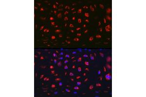 Immunofluorescence analysis of Rat cartilage using MGP Rabbit pAb (ABIN6128268, ABIN6143825, ABIN6143826 and ABIN6221090) at dilution of 1:100 (40x lens). (MGP 抗体  (AA 20-103))