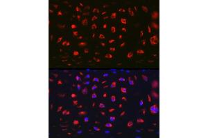 Immunofluorescence analysis of Rat cartilage using MGP Rabbit pAb (ABIN6128268, ABIN6143825, ABIN6143826 and ABIN6221090) at dilution of 1:100 (40x lens). (MGP 抗体  (AA 20-103))