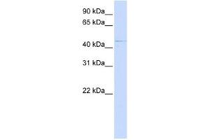 Western Blotting (WB) image for anti-Zinc Finger, DHHC-Type Containing 16 (ZDHHC16) (C-Term) antibody (ABIN635217)