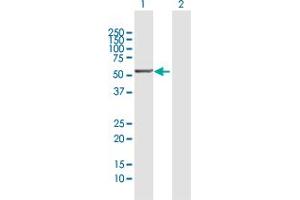 Western Blotting (WB) image for anti-Prostaglandin I2 (Prostacyclin) Synthase (PTGIS) (AA 1-500) antibody (ABIN948349)